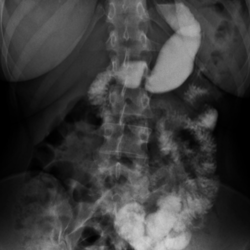 Togd Transit Oeso Gastro Duodenal Paris 18 17 92 93 94 95 Doctolib